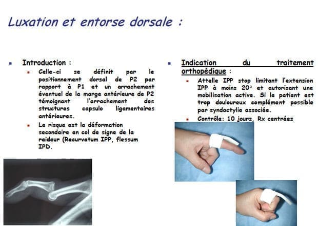 découvrez l'importance de la dorsale dans le maintien de la posture et le soutien de notre corps. apprenez comment elle influence notre santé globale et les bienfaits d'une bonne santé dorsale.